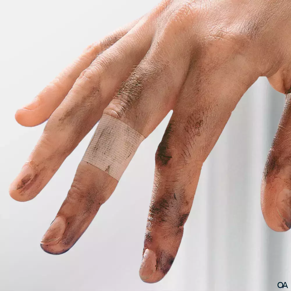 Leukoplast® Barrier Pflaster 22 x 72mm