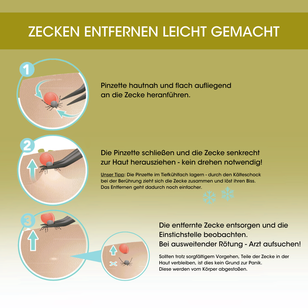 canal ZECKEN PINZETTE ROSTFREI FÜR MENSCHEN