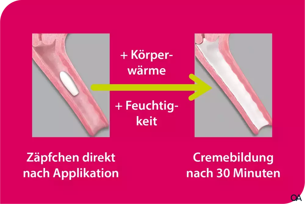 Vagisan FeuchtCreme Cremolum Zäpfchen