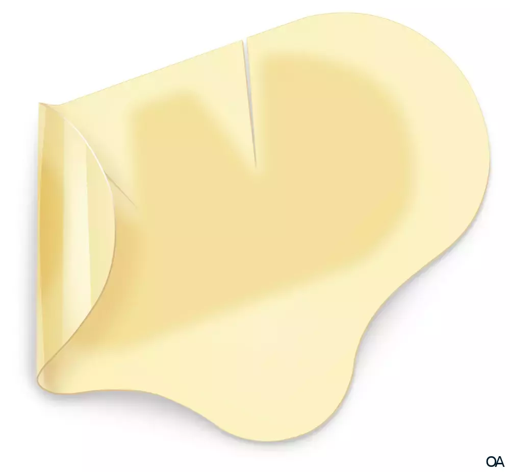 Hydrocoll® Hydrokolloider Wundverband steril, 7,5 x 7,5 cm