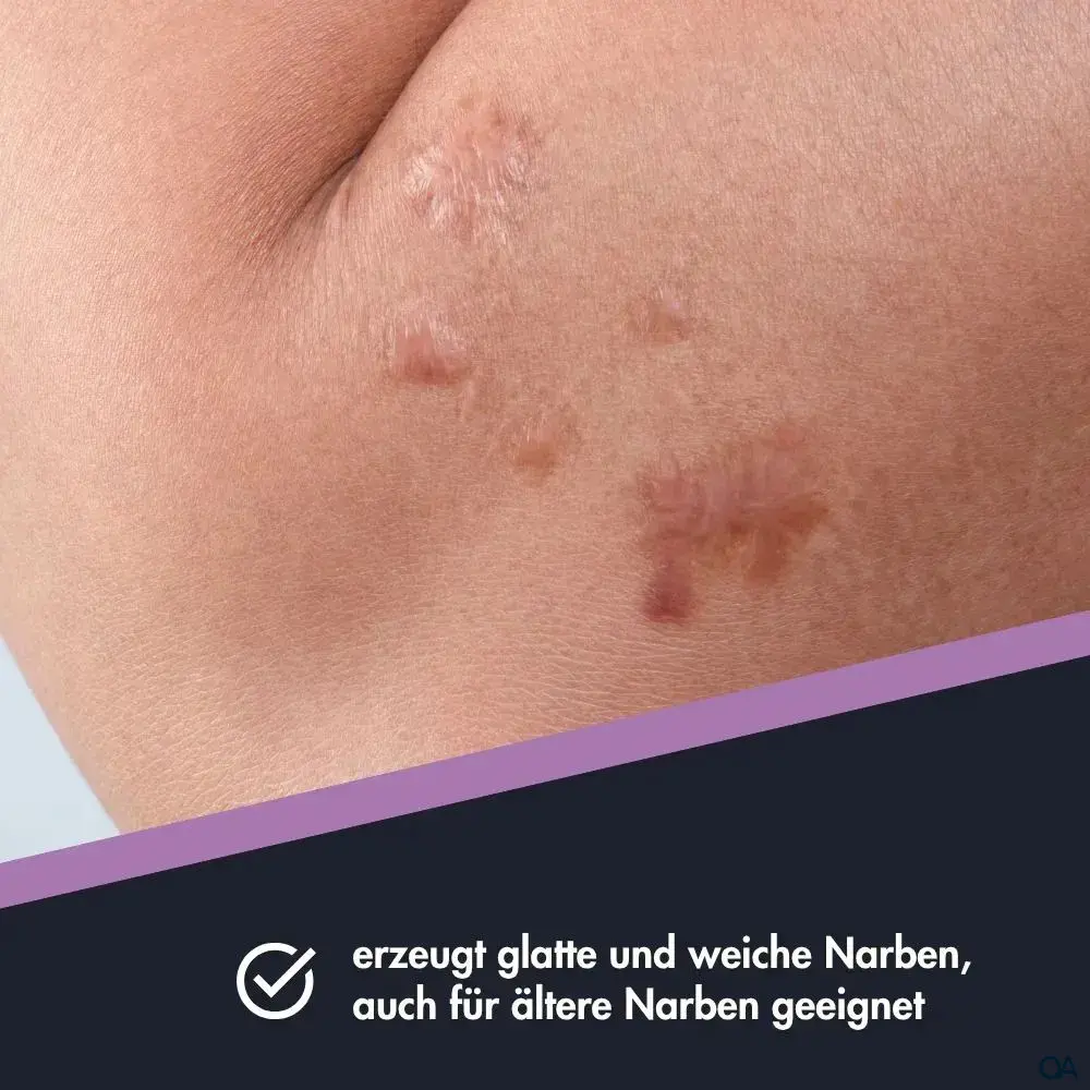 Ensbona® Narbenpflege Salbe Ensbona® Narbenpflege Salbe