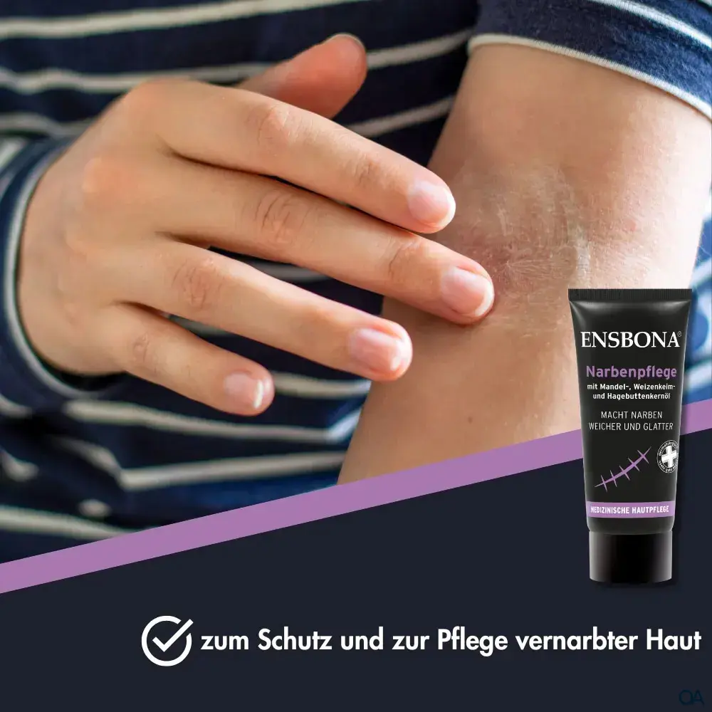 Ensbona® Narbenpflege Salbe Ensbona® Narbenpflege Salbe