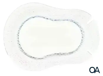 ORTOPAD® Augenokklusionspflaster Weiß Regular 85 x 59 mm